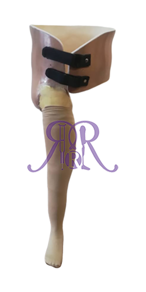 Prostheses - Hip-Disarticulation-Prosthesis.png