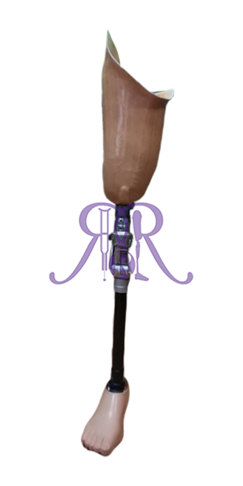 Prostheses - Transfemoral-Prosthesis-with-Lamination-Socket.png